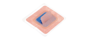 StayFIX Fixation Device