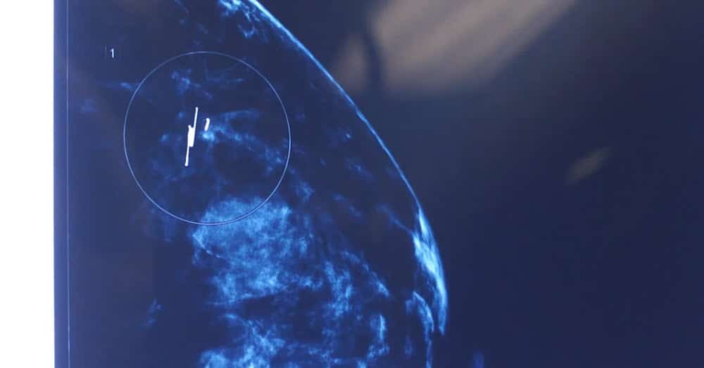 PRECISION & PATIENT EXPERIENCE WIRE-FREE LOCALIZATION