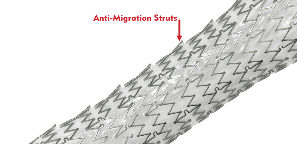 EndoMAXX - Designed with Anti-Migration Struts