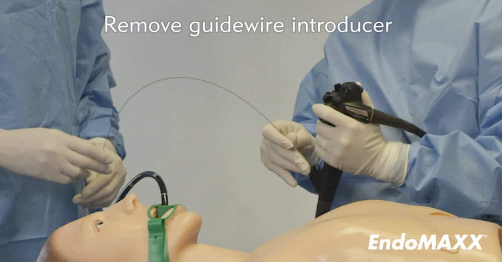 Esophageal Stent Deployment System