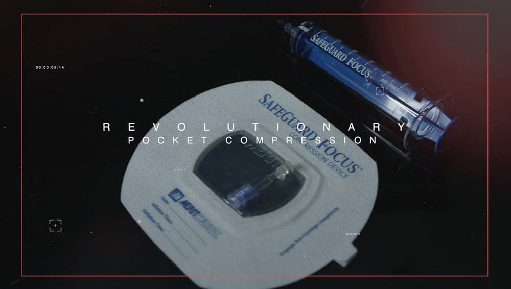 Introducing the SafeGuard Focus