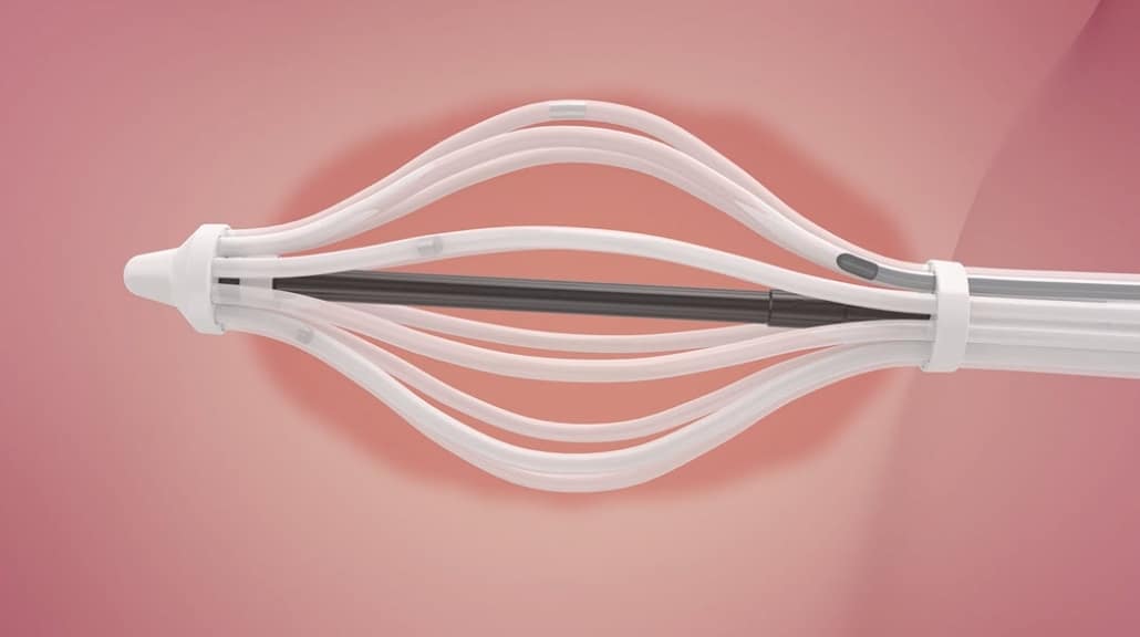 INTRODUCING SAVI BRACHYTHERAPY