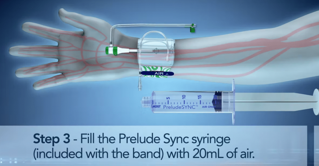 PreludeSYNC™ Radial Compression Device