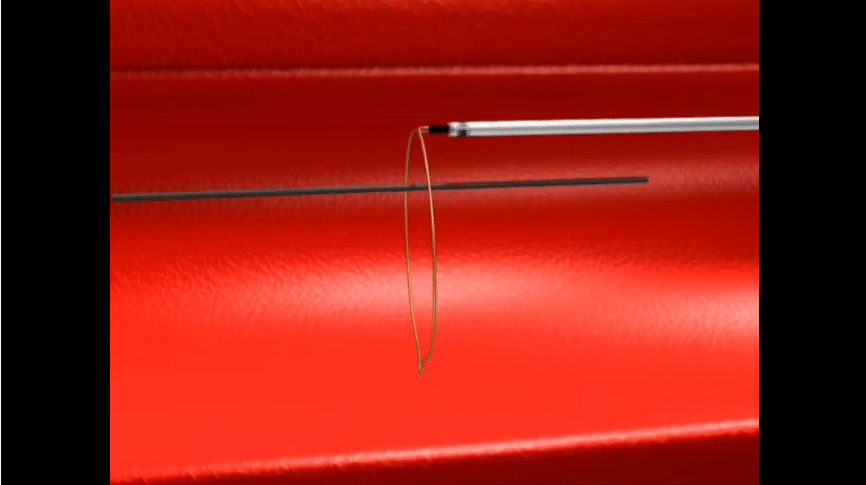 ONE Snare® Endovascular Snare System