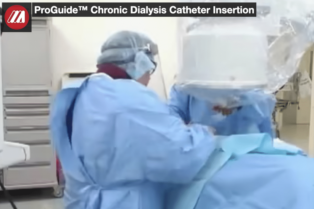 ProGuide™ Chronic Dialysis Catheter Insertion