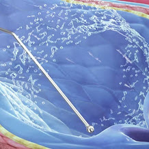 Venous Solutions from Merit Medical