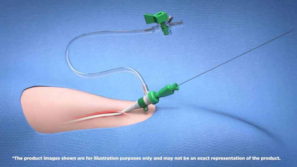 PRELUDE ROADSTER GUIDE SHEATH [IN-SERVICE]