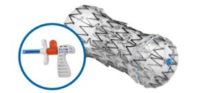 AERO Tracheobronchial Stent