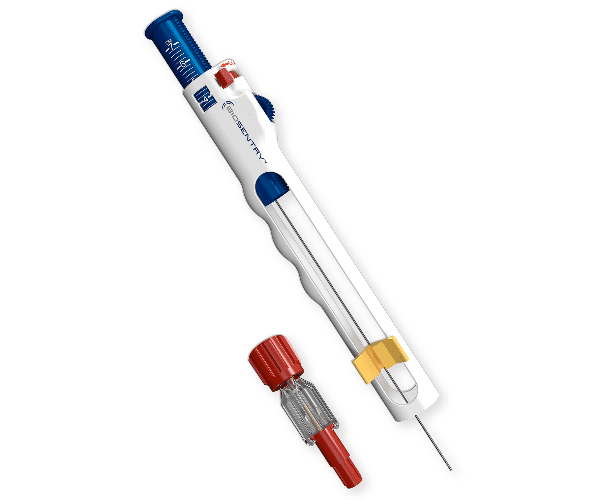 BioSentry® Tract Sealant System