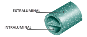 Cut out of the BioFlo Duramax catheter showing the extraluminal surface, and the intraluminal surface
