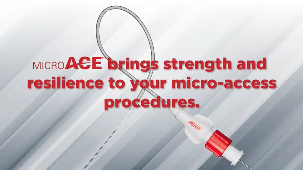 Micro ACE™ Micro-Access System [In-service]